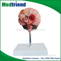 MFM003 Wholesale China Human Brain Model